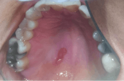 Figure 9: Case report patient 2 BN Figure 9: Case report patient 2 BN