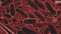 image of the bacteria Tannerella forsythia image of the bacteria Tannerella forsythia