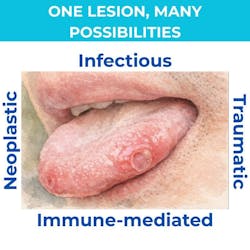 four different classifications of oral lesions four different classifications of oral lesions