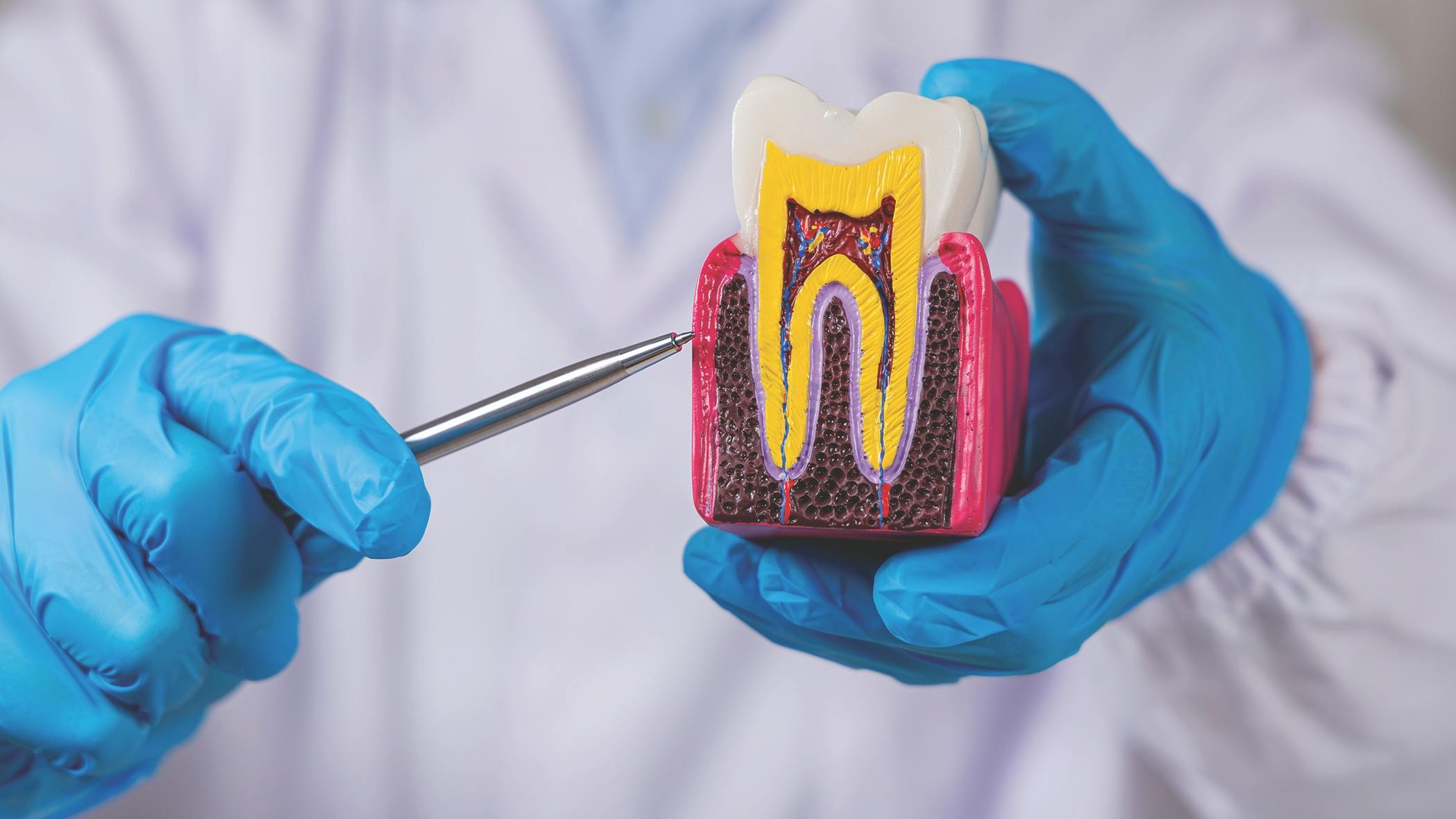 a dental professional holding a model of a tooth