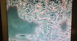 Figure 1: Phase-contrast microscopy image of an adolescent plaque biofilm demonstrating dense, adherent biofilm architecture with numerous oval and elongated yeastlike morphologies and areas of stagnation. These features are consistent with an oral ecology that favors fungal overrepresentation. Phase-contrast microscopy is used to observe biofilm structure and ecological patterns and does not diagnose specific microbial species. Figure 1: Phase-contrast microscopy image of an adolescent plaque biofilm demonstrating dense, adherent biofilm architecture with numerous oval and elongated yeastlike morphologies and areas of stagnation. These features are consistent with an oral ecology that favors fungal overrepresentation. Phase-contrast microscopy is used to observe biofilm structure and ecological patterns and does not diagnose specific microbial species.