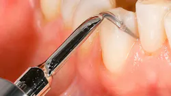 using an ultrasonic dental instrument