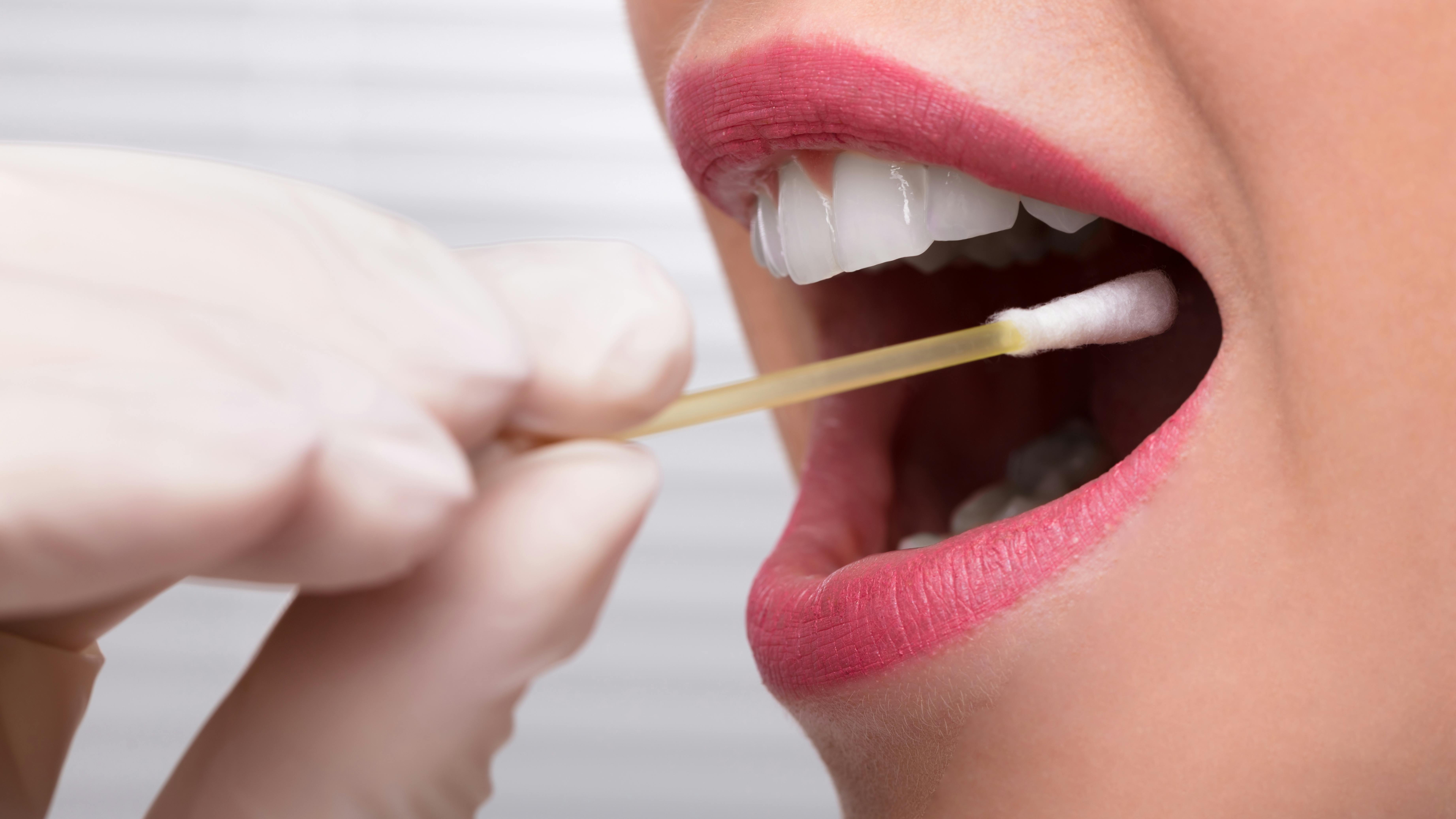 salivary testing