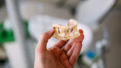 Dental implant model held in a clinical setting to represent implant maintenance protocols for hygienists. Dental implant model held in a clinical setting to represent implant maintenance protocols for hygienists.