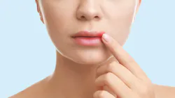 woman pointing out a sore on her mouth woman pointing out a sore on her mouth