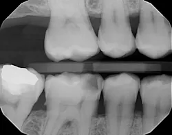 Figure 1: Radiographic analysis without AI