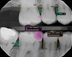 Figure 2: AI-assisted radiographic analysis