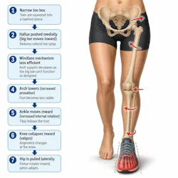 Figure 1: Footwear's influence on lower extremity functions