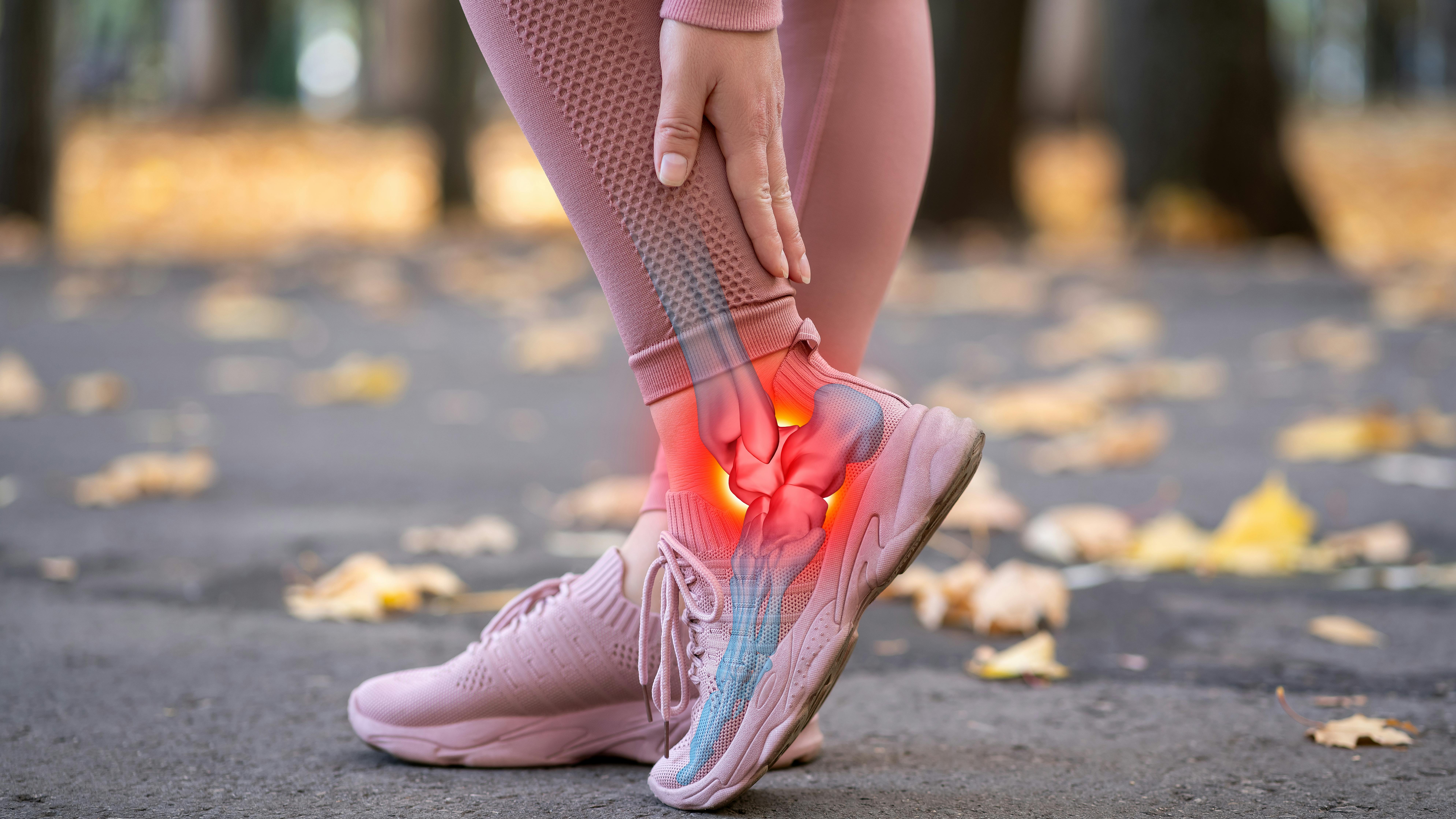 woman's feet (outside) indicating the pain she's experiencing