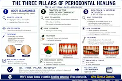 The 3 pillars of periodontal healing