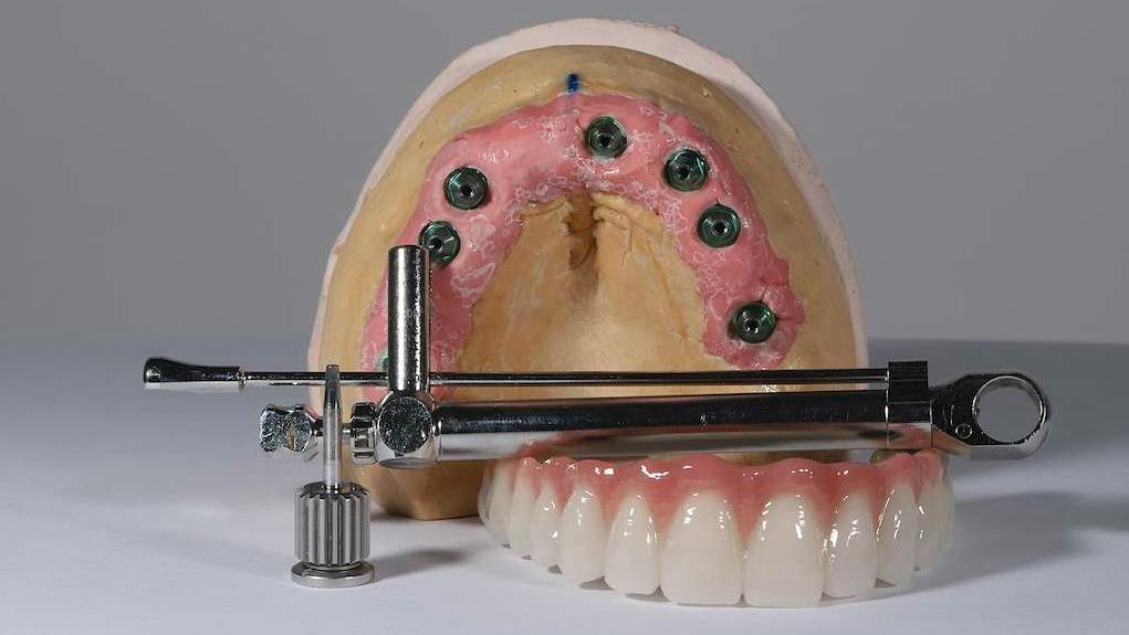 Image of a dental typodont along with a torque wrench used for implants